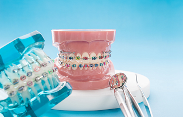 Когда лучше начинать ортодонтическое лечение?